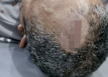 Dikeroyok OTK Pakai Sebo, Dua Security Kebun Marjandi Mengalami Luka