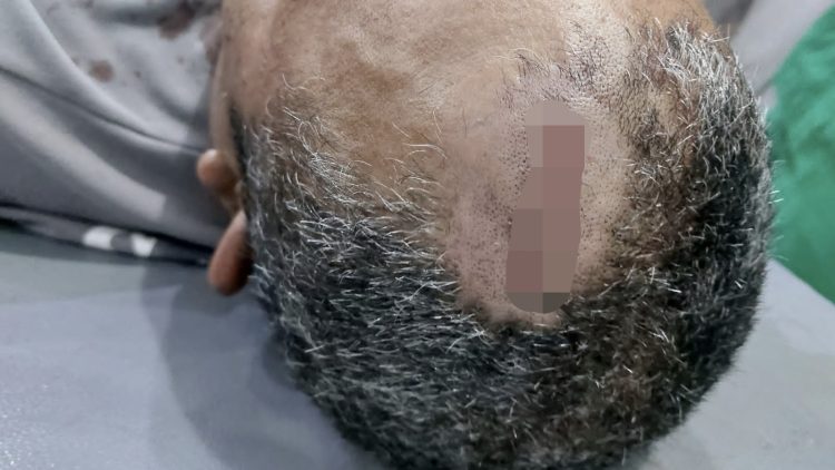 Dikeroyok OTK Pakai Sebo, Dua Security Kebun Marjandi Mengalami Luka