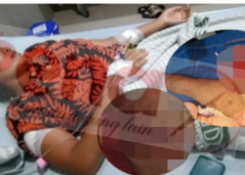 Istri Masuk Rumah Sakit Usai Dibacok Suami